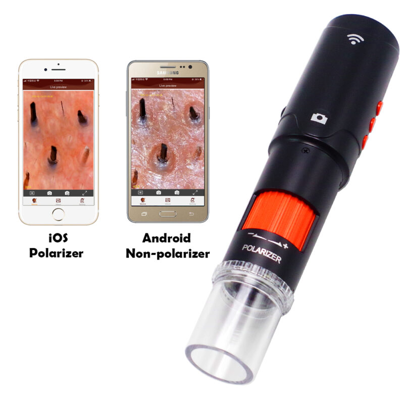 Professional Polarized Dermatoscope & Trichoscope - Wireless HD Hair Scope Scalp Analyzer for Dermatology Clinic & Head Spa