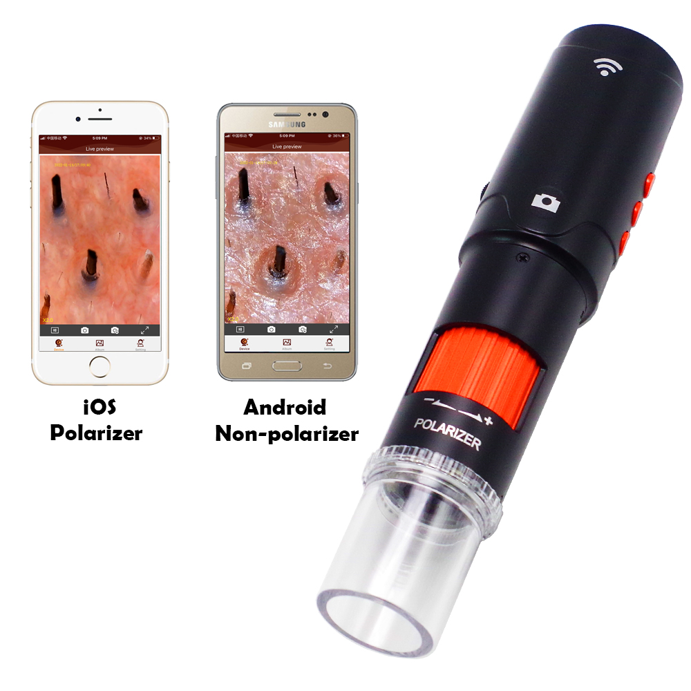 Professional Polarized Dermatoscope & Trichoscope - Wireless HD Hair Scope Scalp Analyzer for Dermatology Clinic & Head Spa