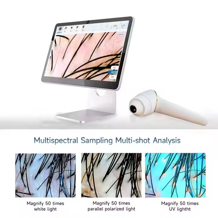 AI Intelligent 2-in-1 Hair & Scalp Analyzer - Professional HD Digital Trichoscope & Skin Detector Machine for Salon & Spa - Image 4