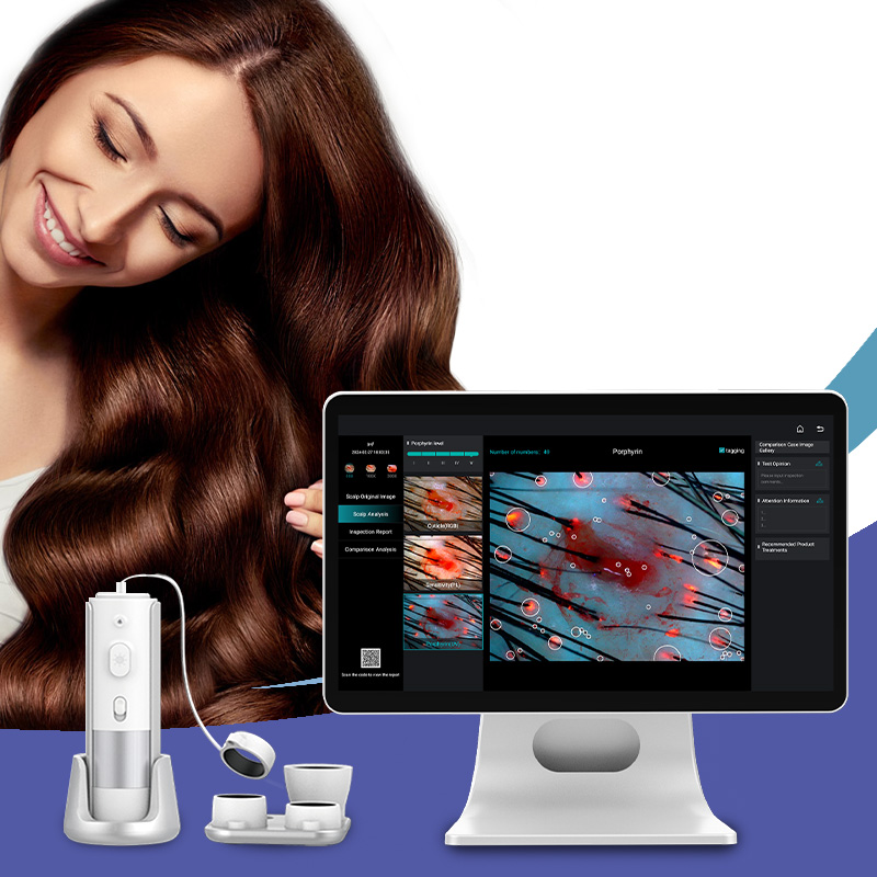AI Intelligent Analysis Hair Tester & Skin Analyzer Machine with Cloud Data Storage