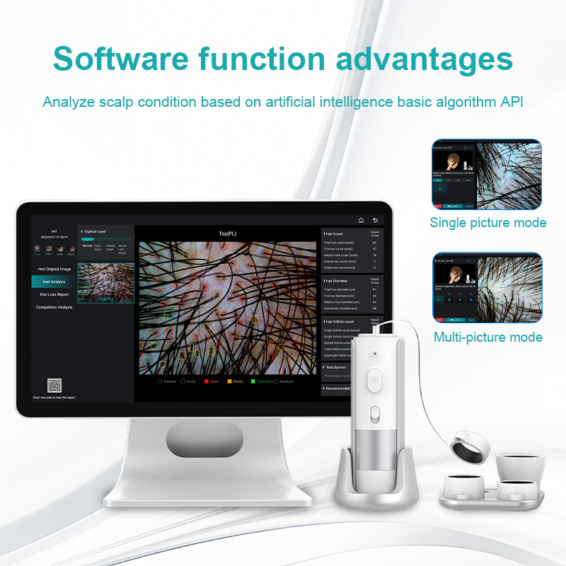 AI Intelligent Analysis Hair Tester & Skin Analyzer Machine with Cloud Data Storage - Image 4