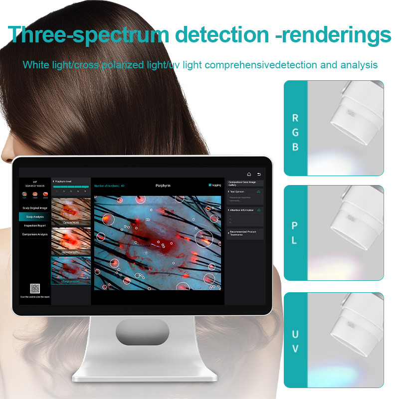 AI Intelligent Analysis Hair Tester & Skin Analyzer Machine with Cloud Data Storage - Image 6