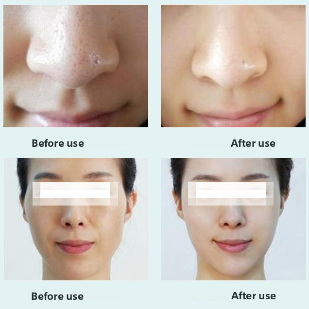koopotech CGK-SA003 Hydro Oxygen Bubble Facial Beauty Machine 9In1 Multifunction Standing Aquafacial Gerat Skin Hydro Cleaning Beauty Device - Image 4